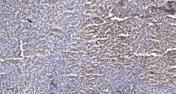 Immunohistochemical analysis of paraffin-embedded human liver cancer