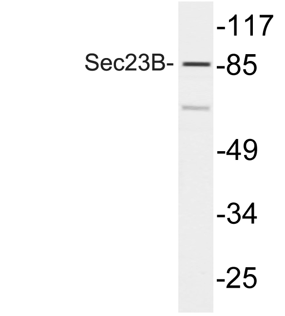 Western blot analysis of lysate from COLO205 cells, using Sec23B antibody