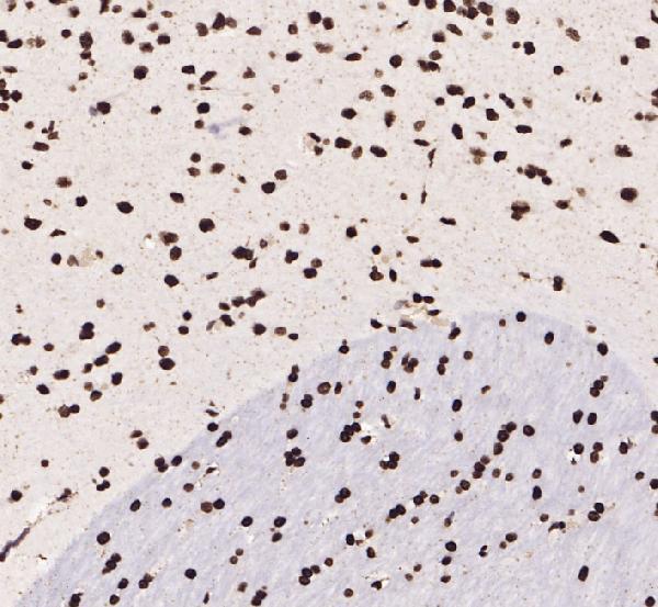 Immunohistochemical analysis of paraffin-embedded mouse-brain, antibody was diluted at 1:100