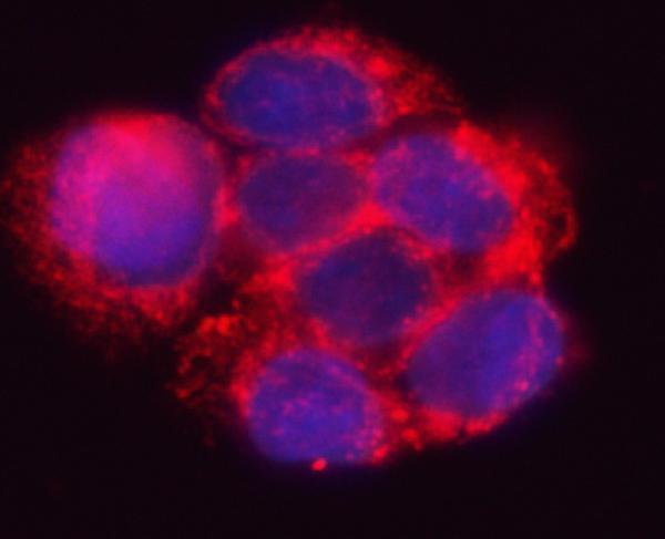 a05850 1 hsd17b7 primary antibodies if testing 5