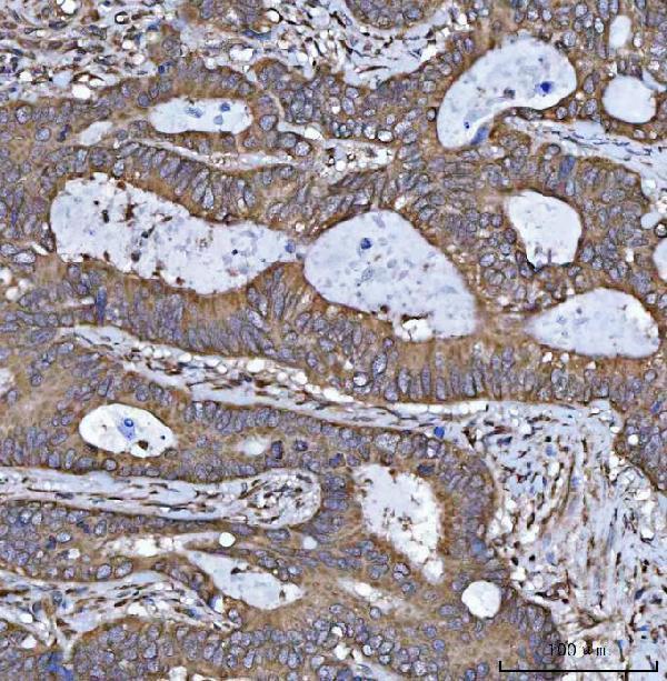 a05850 1 hsd17b7 primary antibodies ihc testing 4