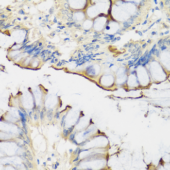 a05852 crtap primary antiboties ihc testing 2