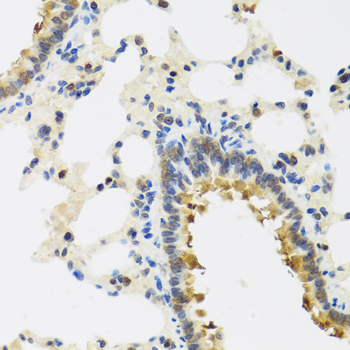 a05852 crtap primary antiboties ihc testing 3