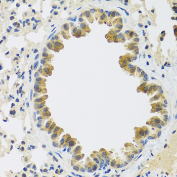 a05852 crtap primary antiboties ihc testing 4