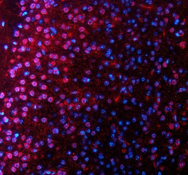 a05853 1 sall2 primary antibodies if testing 1