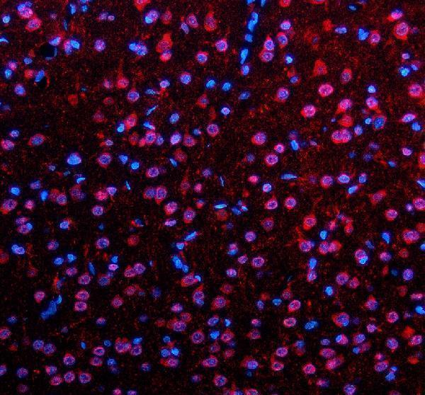 a05853 1 sall2 primary antibodies if testing 2