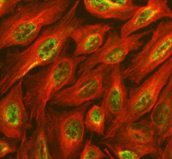 a05853 1 sall2 primary antibodies if testing 3