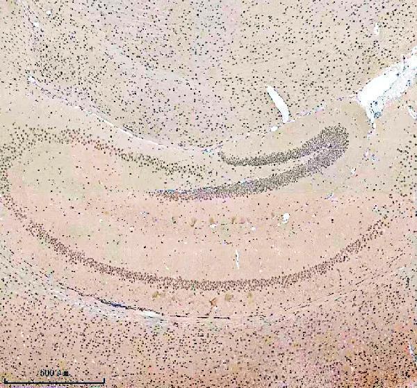 a05853 1 sall2 primary antibodies ihc testing 1