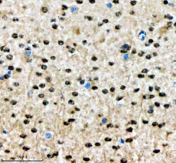 a05853 1 sall2 primary antibodies ihc testing 2