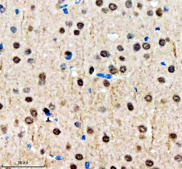 a05853 1 sall2 primary antibodies ihc testing 4