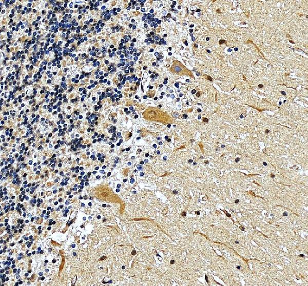 a05853 1 sall2 primary antibodies ihc testing 5