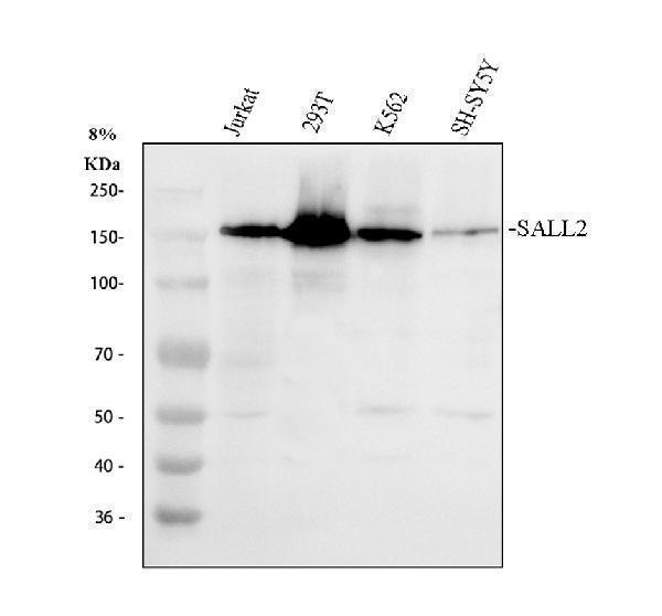 a05853 1 sall2 primary antibodies wb testing 1
