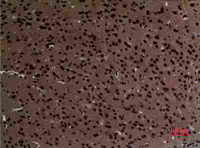 a05855 strn primary antibodyes ihc testing 1
