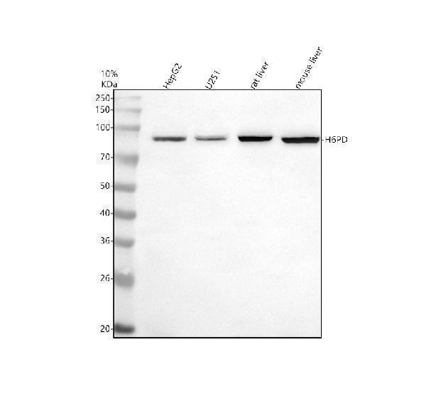 Western blot analysis of H6PD using anti-H6PD antibody (A05856-1)