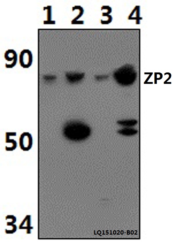 a05859 zp2 primary antiboties wb testing 1