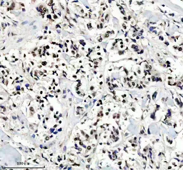 IHC analysis of SRSF9 using anti-SRSF9 antibody (A05860-2)