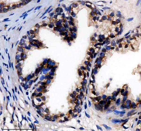 IHC analysis of SRSF9 using anti-SRSF9 antibody (A05860-2)
