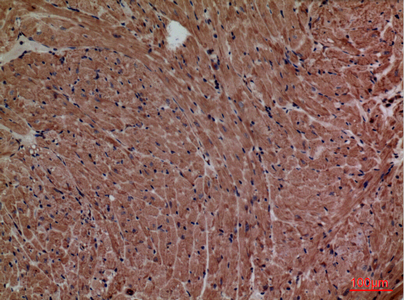 a05861 2 p2rx3 primary antibodyes ihc testing 2