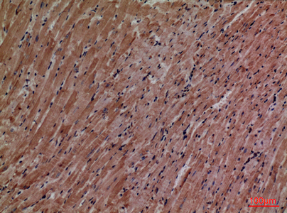 a05861 2 p2rx3 primary antibodyes ihc testing 3