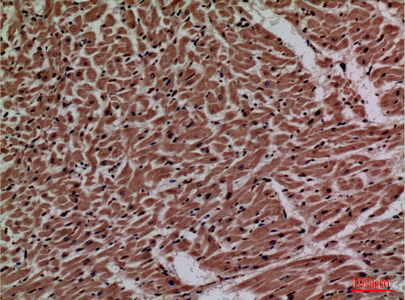 a05861 2 p2rx3 primary antibodyes ihc testing 4