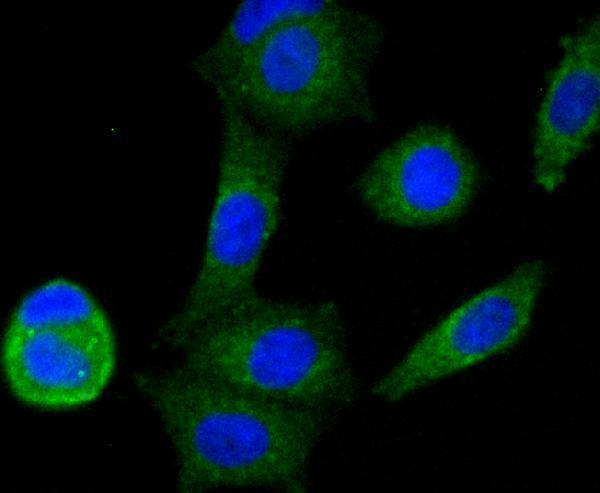 ICC staining NDUFS3 in MCF-7 cells (green)