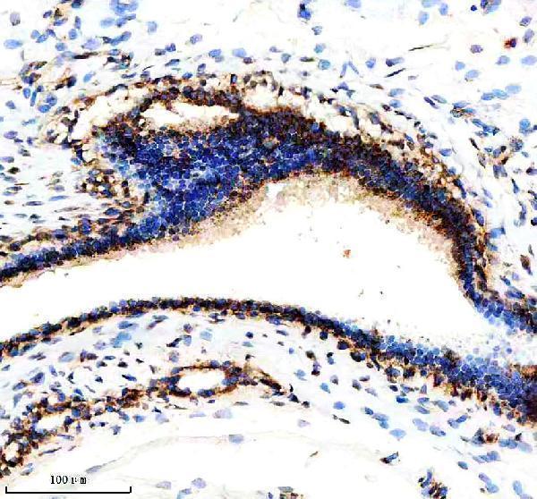  IHC analysis of NDUFS3 using anti-NDUFS3 antibody (A05867-2)
