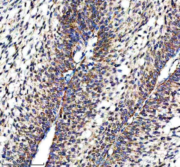  IHC analysis of NDUFS3 using anti-NDUFS3 antibody (A05867-2)