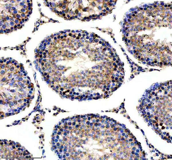 a05867 2 ndufs3 primary antibodies ihc testing 4