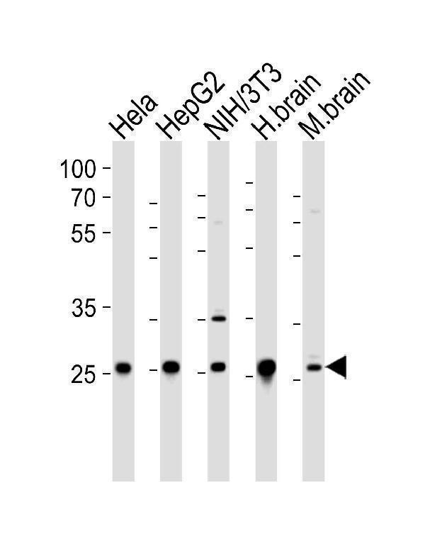 a05867 anti ndufs3 antibody c term wb testing 1