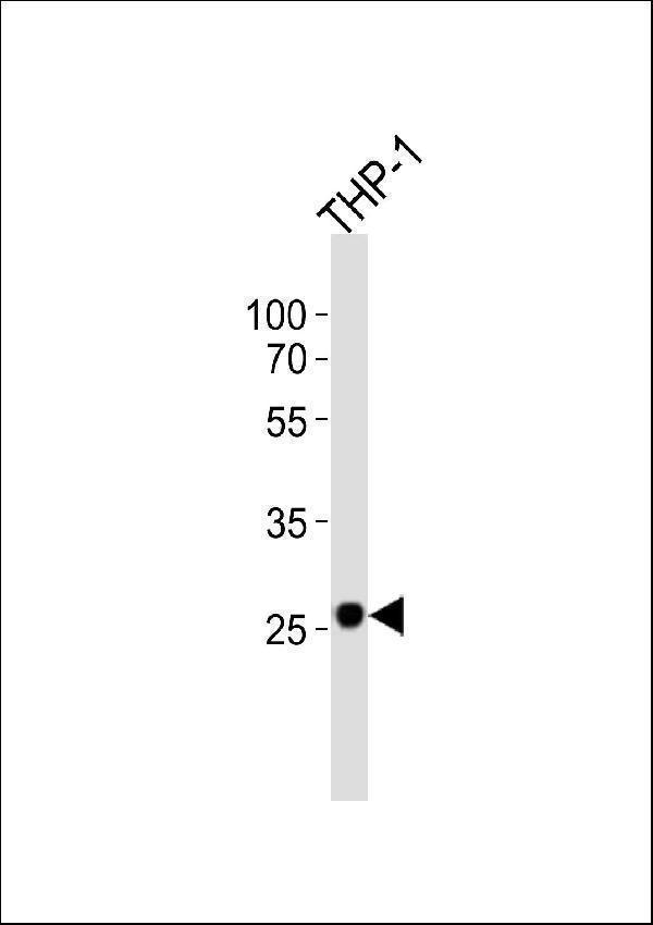 a05867 anti ndufs3 antibody c term wb testing 2