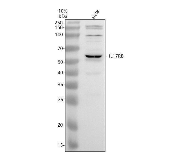 Western blot analysis of IL17RB using anti-IL17RB antibody (A05868-1)