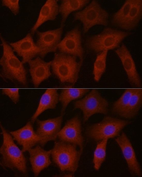 a05869 eif4e2 primary antiboties if testing 4