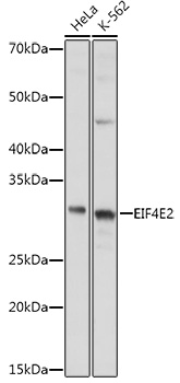 a05869 eif4e2 primary antiboties wb testing 1