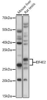a05869 eif4e2 primary antiboties wb testing 2