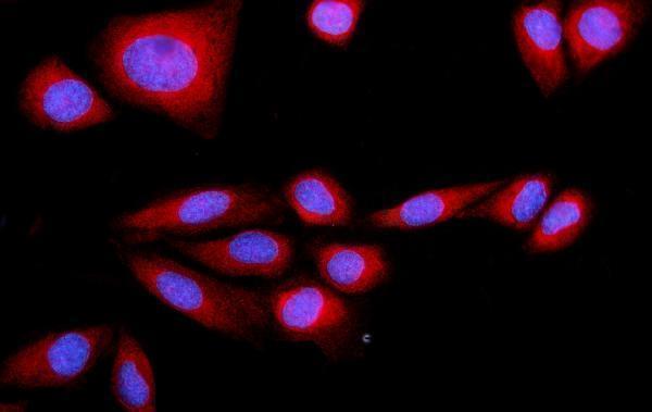 a05873 1 srp72 primary antibodies if testing 8