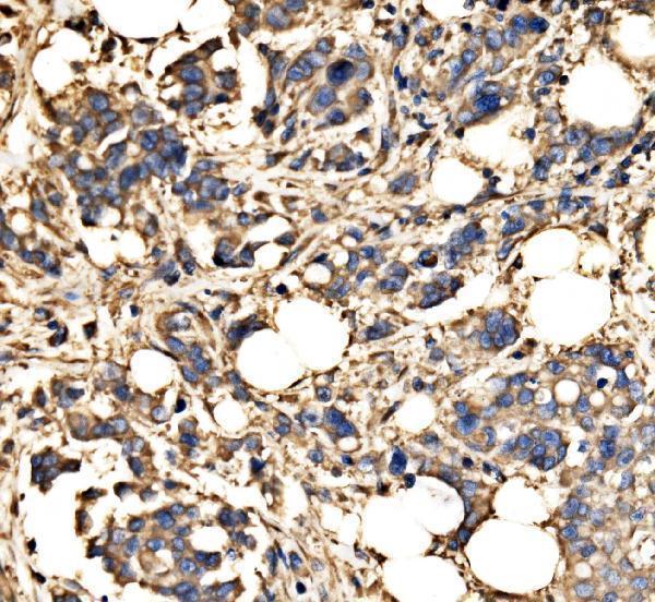  IHC analysis of SRP72 using anti-SRP72 antibody (A05873-1)