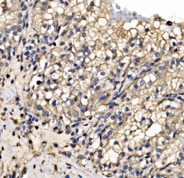  IHC analysis of SRP72 using anti-SRP72 antibody (A05873-1)