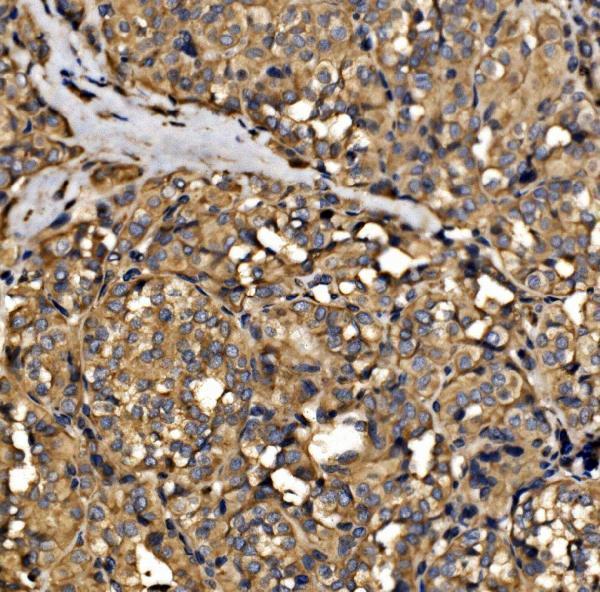 a05873 1 srp72 primary antibodies ihc testing 4