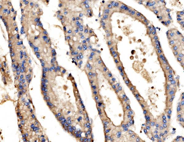 a05873 1 srp72 primary antibodies ihc testing 5