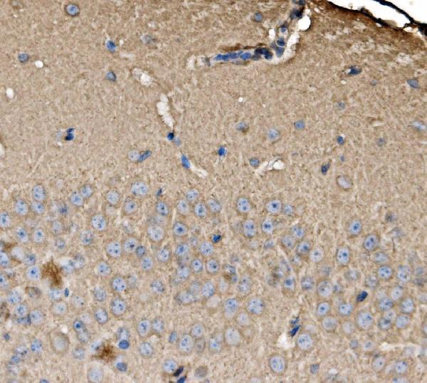 a05873 1 srp72 primary antibodies ihc testing 6