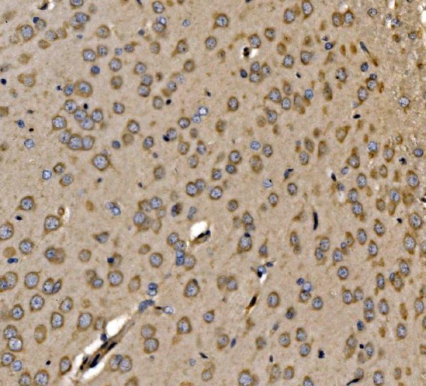a05873 1 srp72 primary antibodies ihc testing 7