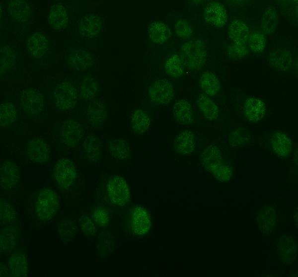  IF analysis of HSPC150/UBE2T using anti-HSPC150/UBE2T antibody (A05874-3)