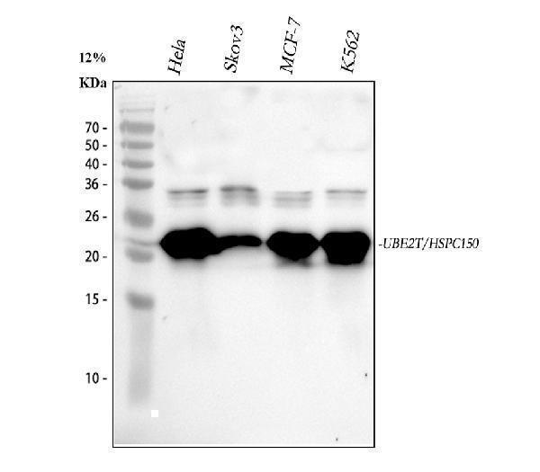  Western blot analysis of HSPC150/UBE2T using anti-HSPC150/UBE2T antibody (A05874-3)