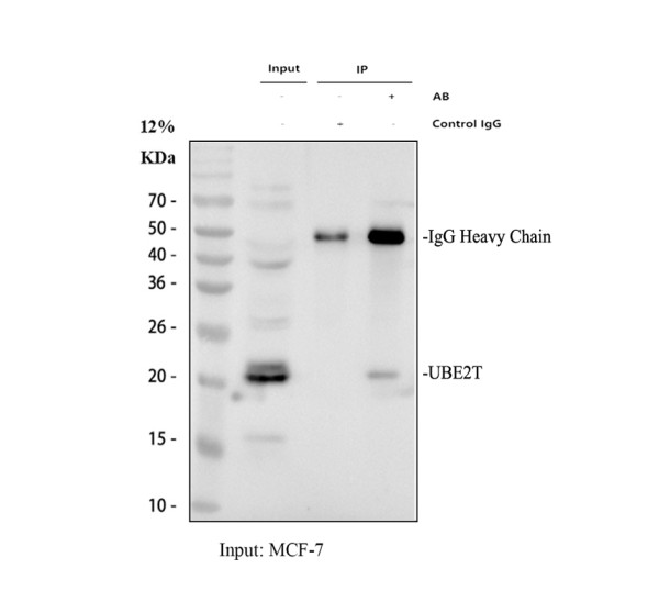 a05874 3 ube2t primary antibodies ip testing 1