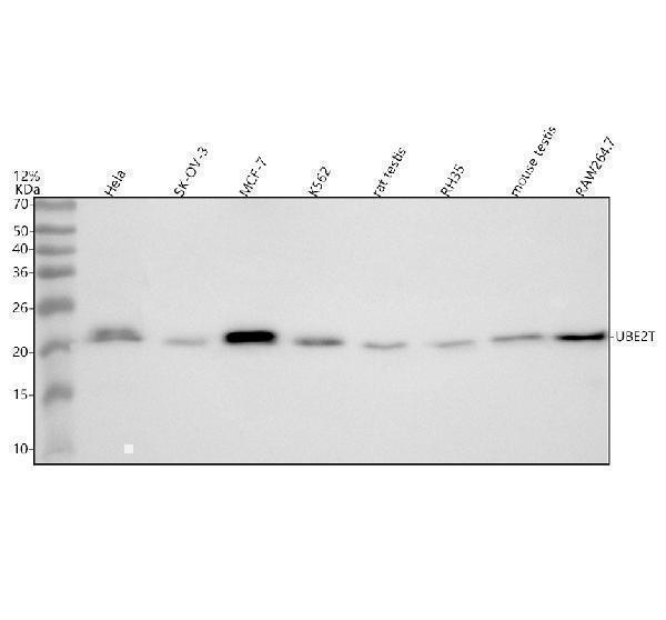 Western blot analysis of UBE2T using anti-UBE2T antibody (A05874-3)