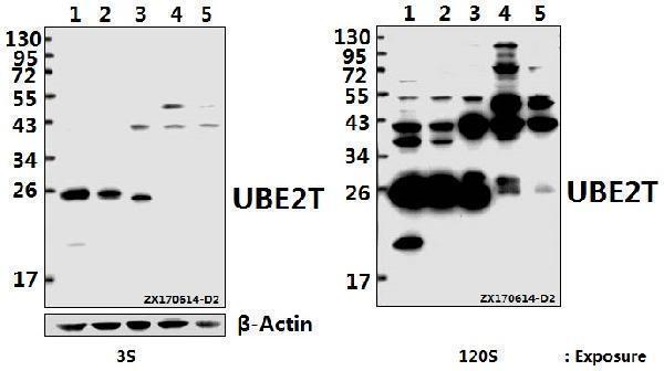 a05874 ube2t primary antiboties wb testing 1