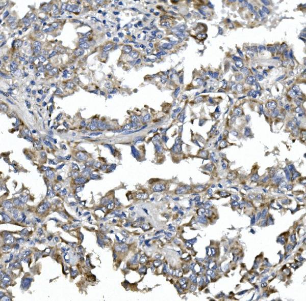 a05876 1 calcoco2 primary antibodies ihc testing 2