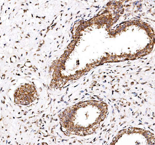 a05876 1 calcoco2 primary antibodies ihc testing 3
