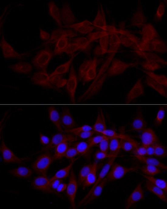 a05876 calcoco2 primary antiboties if testing 2