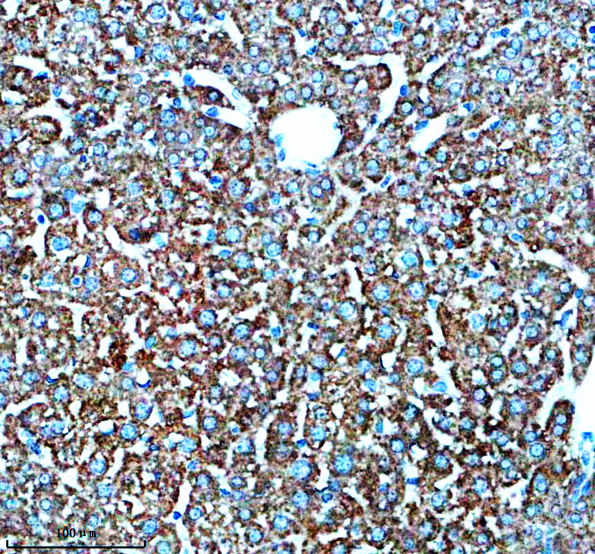 IHC analysis of KLB using anti-KLB antibody (A05877-1)
